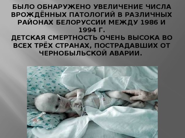 БЫЛО ОБНАРУЖЕНО УВЕЛИЧЕНИЕ ЧИСЛА ВРОЖДЁННЫХ ПАТОЛОГИЙ В РАЗЛИЧНЫХ РАЙОНАХ БЕЛОРУССИИ МЕЖДУ 1986 И 1994 Г.  ДЕТСКАЯ СМЕРТНОСТЬ ОЧЕНЬ ВЫСОКА ВО ВСЕХ ТРЁХ СТРАНАХ, ПОСТРАДАВШИХ ОТ ЧЕРНОБЫЛЬСКОЙ АВАРИИ.   