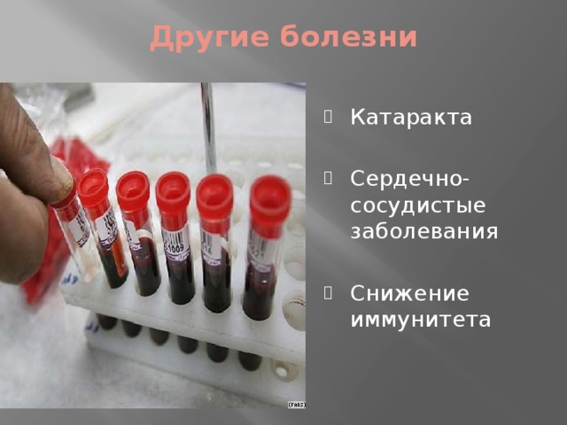 Другие болезни   Катаракта Сердечно-сосудистые заболевания Снижение иммунитета 