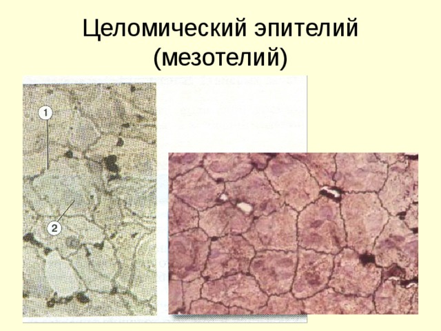 Целомический эпителий (мезотелий) 