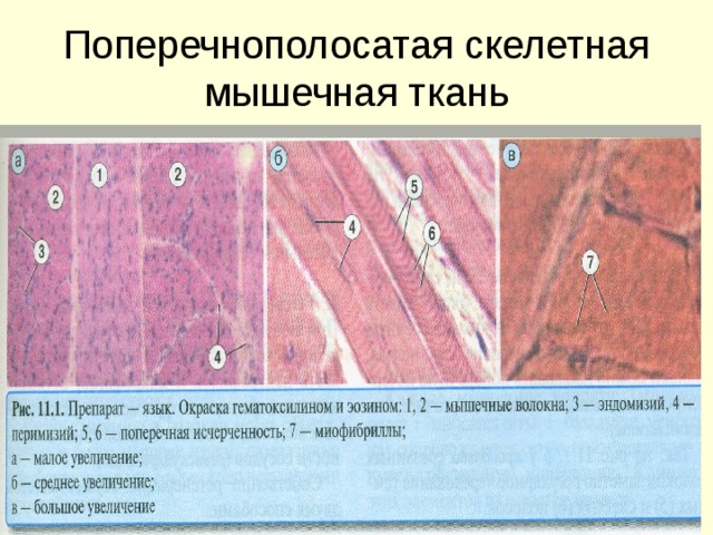 Поперечнополосатая скелетная мышечная ткань 