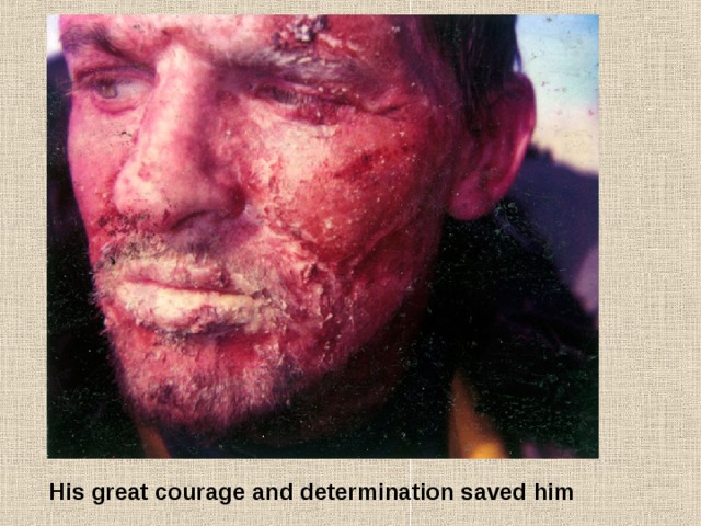 His great courage and determination saved him 