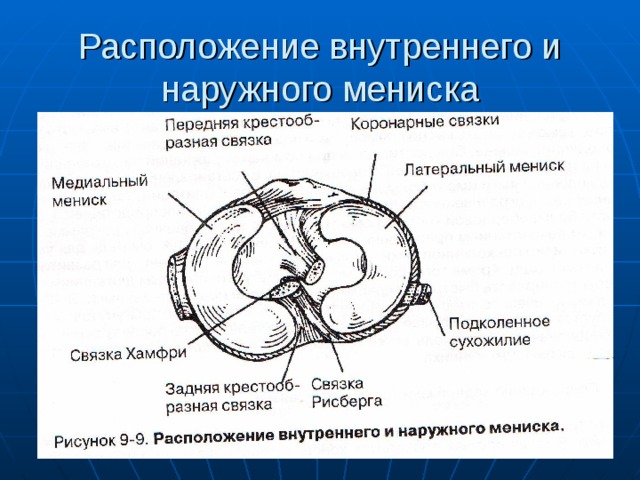 Расположение внутреннего и наружного мениска 