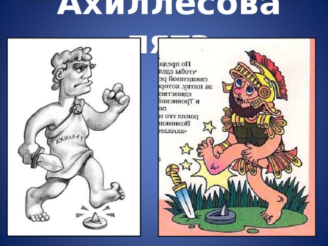Ахиллесова пята 