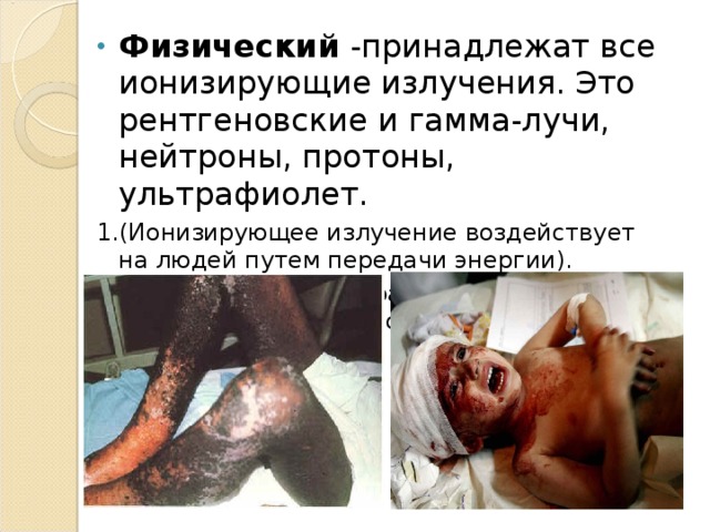 Физический -принадлежат все ионизирующие излучения. Это рентгеновские и гамма-лучи, нейтроны, протоны, ультрафиолет. 1.(Ионизирующее излучение воздействует на людей путем передачи энергии). 2.  При всем этом ультрафиолетовое облучение вызывает сильное воспаление кожи 
