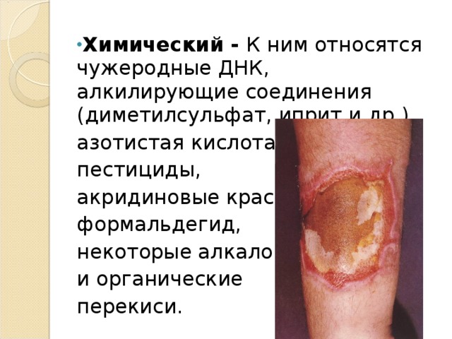 Химический - К ним относятся чужеродные ДНК, алкилирующие соединения (диметилсульфат, иприт и др.), азотистая кислота, пестициды, акридиновые красители, формальдегид, некоторые алкалоиды и органические перекиси. 