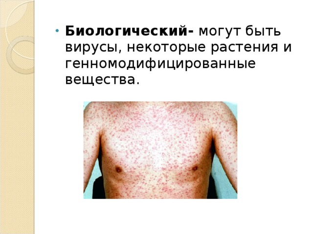 Биологический- могут быть вирусы, некоторые растения и генномодифицированные вещества. 