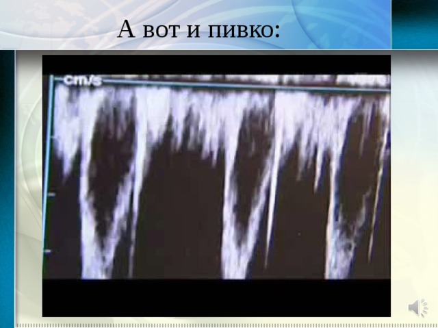 А вот и пивко: 