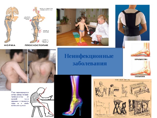 Неинфекционные  заболевания 