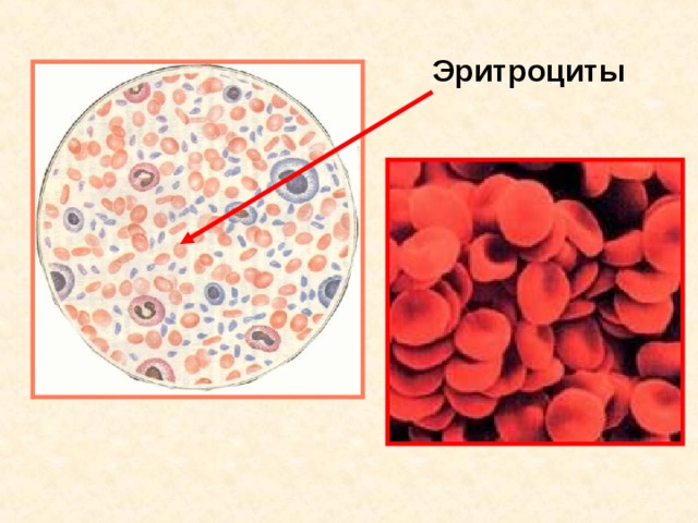 Эритроциты 11 11 