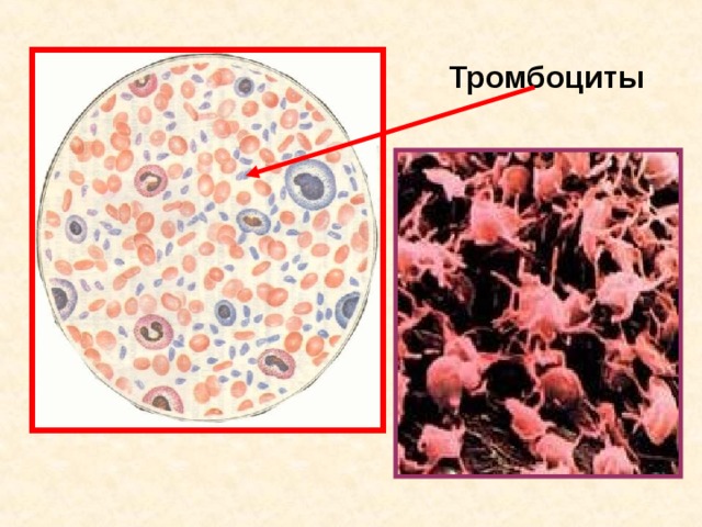 Тромбоциты 11 11 