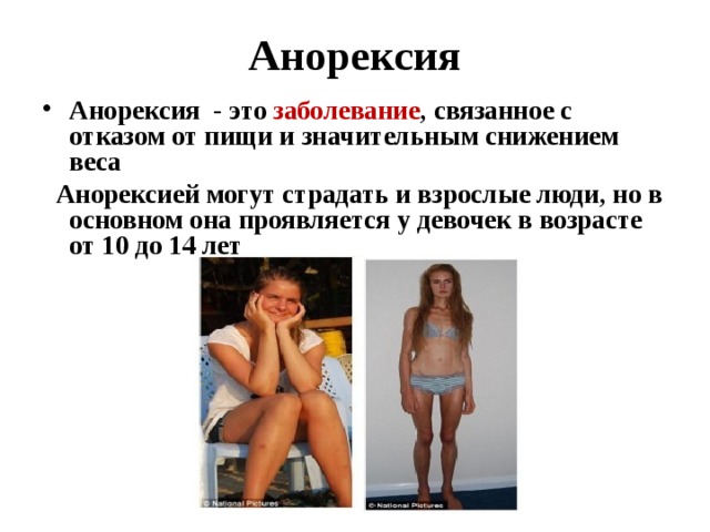  Анорексия  Анорексия - это заболевание , связанное с отказом от пищи и значительным снижением веса  Анорексией могут страдать и взрослые люди, но в основном она проявляется у девочек в возрасте от 10 до 14 лет  