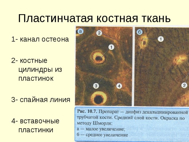 1- канал остеона 2- костные цилиндры из пластинок 3- спайная линия 4- вставочные пластинки 