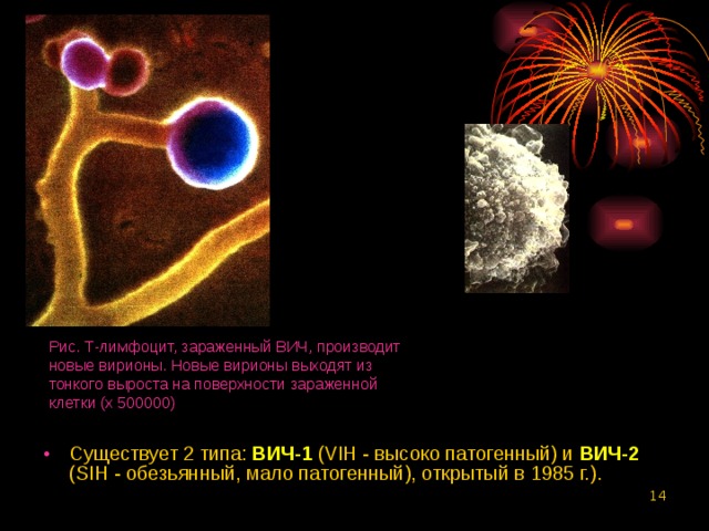 Рис. Т-лимфоцит, зараженный ВИЧ, производит новые вирионы. Новые вирионы выходят из тонкого выроста на поверхности зараженной клетки (х 500000) Существует 2 типа: ВИЧ-1 (VIH - высоко патогенный) и ВИЧ-2 (SIH - обезьянный, мало патогенный), открытый в 1985 г.).   