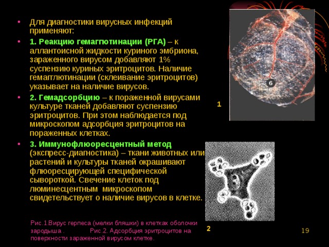 Для диагностики вирусных инфекций применяют: 1. Реакцию гемаггютинации (РГА)  – к аллантоисной жидкости куриного эмбриона, зараженного вирусом добавляют 1% суспензию куриных эритроцитов. Наличие гемагглютинации (склеивание эритроцитов) указывает на наличие вирусов. 2. Гемадсорбцию – к пораженной вирусами культуре тканей добавляют суспензию эритроцитов. При этом наблюдается под микроскопом адсорбция эритроцитов на пораженных клетках. 3. Иммунофлюоресцентный метод  (экспресс-диагностика) – ткани животных или растений и культуры тканей окрашивают флюоресцирующей специфической сывороткой. Свечение клеток под люминесцентным микроскопом свидетельствует о наличие вирусов в клетке. 1 Рис.1.Вирус герпеса (мелки бляшки) в клетках оболочки зародыша . Рис.2. Адсорбция эритроцитов на поверхности зараженной вирусом клетке. 2  