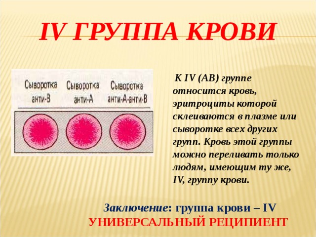 IV ГРУППА КРОВИ  К IV (АВ) группе относится кровь, эритроциты которой склеиваются в плазме или сыворотке всех других групп. Кровь этой группы можно переливать только людям, имеющим ту же, IV, группу крови. Заключение : группа крови – IV УНИВЕРСАЛЬНЫЙ РЕЦИПИЕНТ  