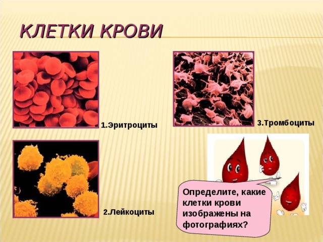 КЛЕТКИ КРОВИ  1.Эритроциты  3.Тромбоциты Определите, какие клетки крови изображены на фотографиях?  2.Лейкоциты 