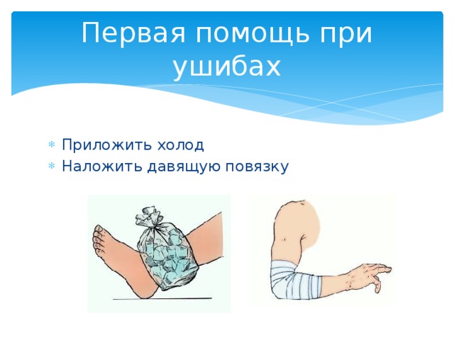 Первая помощь при ушибах Приложить холод Наложить давящую повязку 