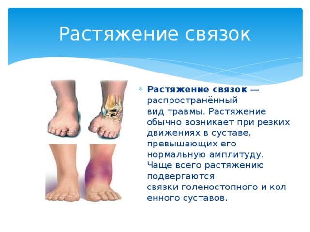 Растяжение связок Растяжение связок  — распространённый вид травмы. Растяжение обычно возникает при резких движениях в суставе, превышающих его нормальную амплитуду. Чаще всего растяжению подвергаются связки голеностопного и коленного суставов. 