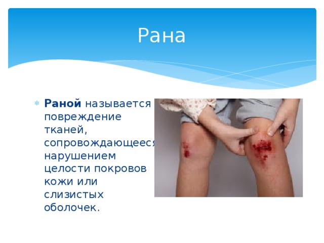 Рана Раной  называется повреждение тканей, сопровождающееся нарушением целости покровов кожи или слизистых оболочек. 