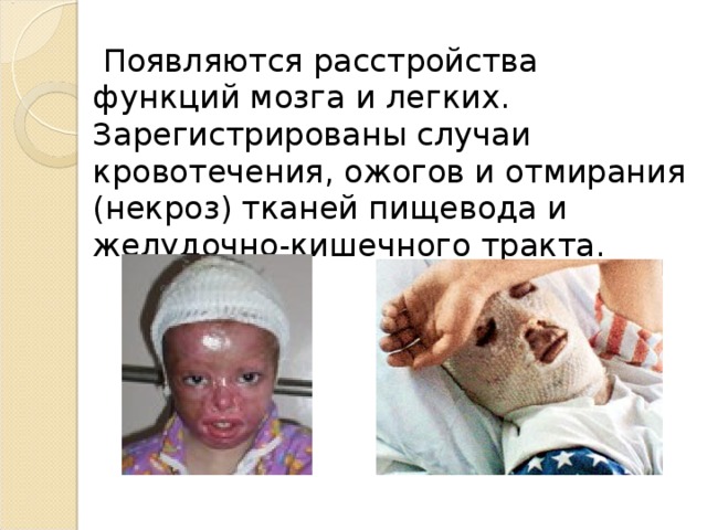   Появляются расстройства функций мозга и легких. Зарегистрированы случаи кровотечения, ожогов и отмирания (некроз) тканей пищевода и желудочно-кишечного тракта. 