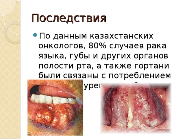 Последствия По данным казахстанских онкологов, 80% случаев рака языка, губы и других органов полости рта, а также гортани были связаны с потреблением насвая и курением табака.  