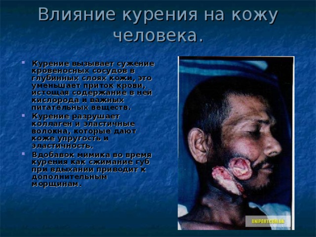 Влияние курения на кожу человека.  Курение вызывает сужение кровеносных сосудов в глубинных слоях кожи, это уменьшает приток крови, истощая содержание в ней кислорода и важных питательных веществ. Курение разрушает коллаген и эластичные волокна, которые дают коже упругость и эластичность. Вдобавок мимика во время курения как сжимание губ при вдыхании приводит к дополнительным морщинам. 