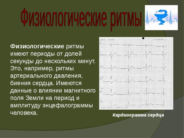    Физиологические  ритмы имеют периоды от долей секунды до нескольких минут. Это, например, ритмы артериального давления, биения сердца. Имеются данные о влиянии магнитного поля Земли на период и амплитуду энцефалограммы человека.     Кардиограмма сердца 