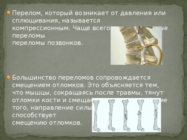 Перелом, который возникает от давления или сплющивания, называется компрессионным. Чаще всего компрессионные переломы – это переломы позвонков.   Большинство переломов сопровождается смещением отломков. Это объясняется тем, что мышцы, сокращаясь после травмы, тянут отломки кости и смещают их в сторону. Кроме того, направление силы удара тоже способствует смещению отломков.  