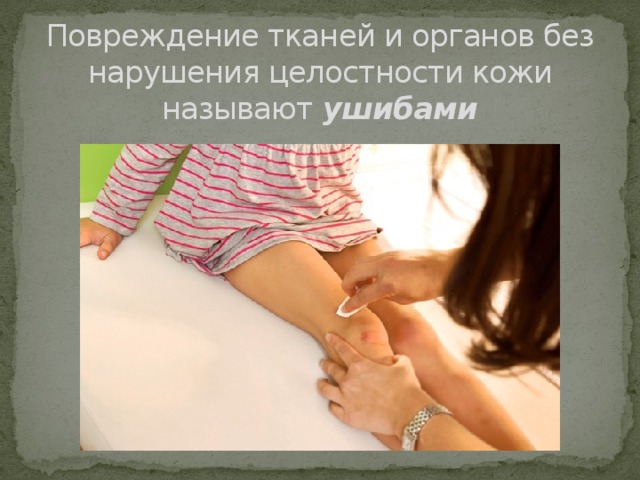 Повреждение тканей и органов без нарушения целостности кожи называют ушибами 
