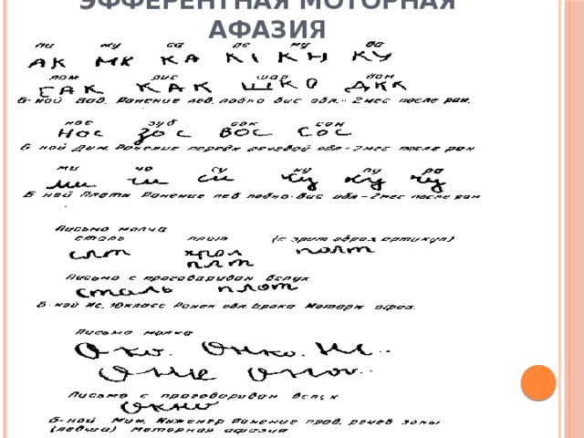 Эфферентная моторная афазия 