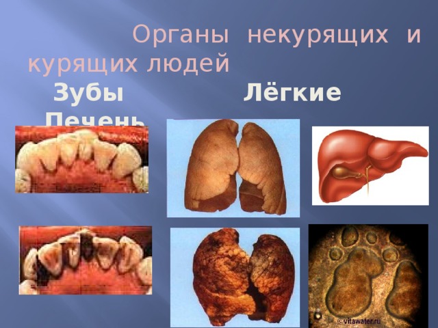  Органы некурящих и курящих людей  Зубы Лёгкие Печень   