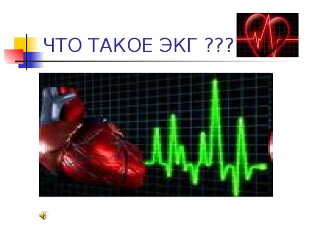 ЧТО ТАКОЕ ЭКГ ??? 