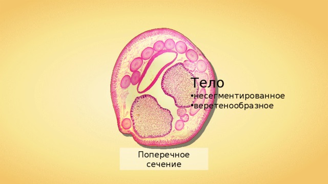 Тело несегментированное веретенообразное Поперечное сечение 