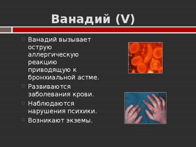  Ванадий ( V ) Ванадий вызывает острую аллергическую реакцию приводящую к бронхиальной астме. Развиваются заболевания крови. Наблюдаются нарушения психики. Возникают экземы. 