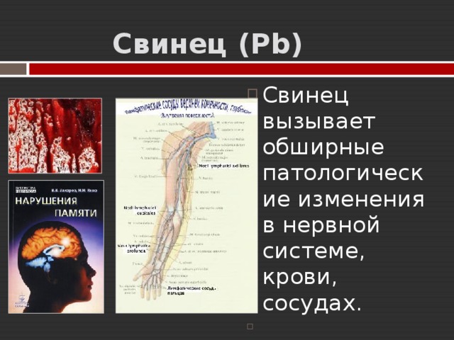   Свинец  ( Pb ) Свинец вызывает обширные патологические изменения в нервной системе, крови, сосудах . 
