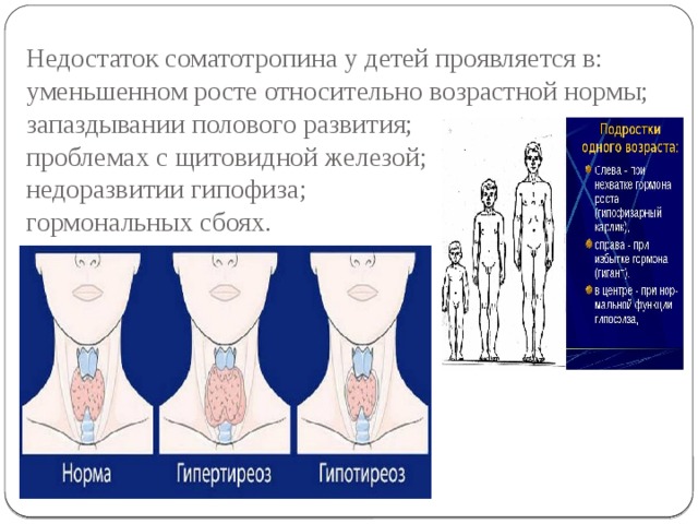Недостаток соматотропина у детей проявляется в:  уменьшенном росте относительно возрастной нормы;  запаздывании полового развития;  проблемах с щитовидной железой;  недоразвитии гипофиза;  гормональных сбоях.   