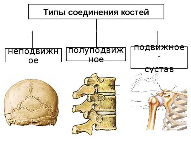 Типы соединения костей подвижное - сустав полуподвижное неподвижное 