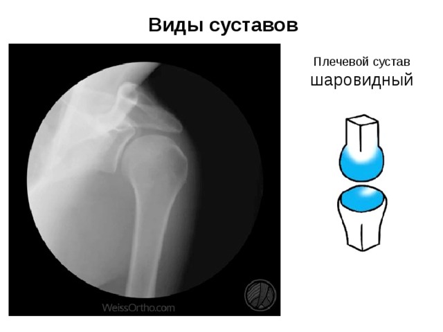 Виды суставов Плечевой сустав шаровидный 