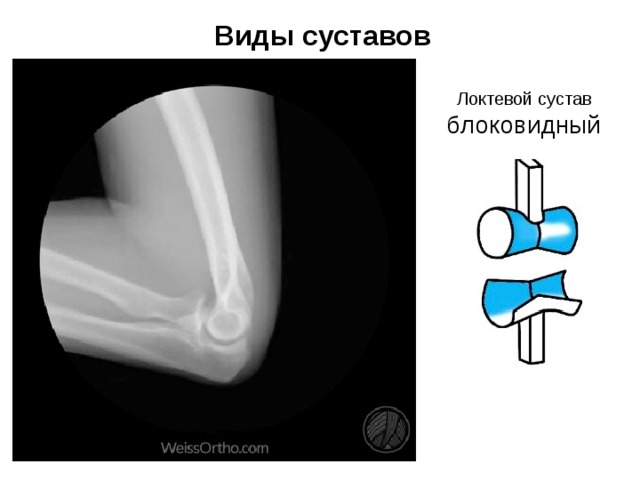 Виды суставов Локтевой сустав блоковидный 