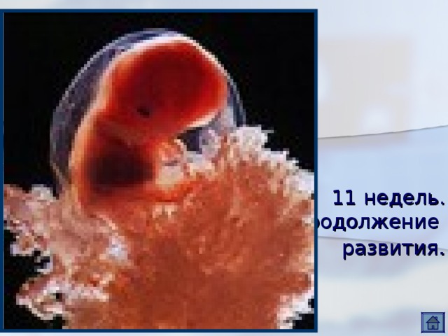 11 недель.  Продолжение  развития . 