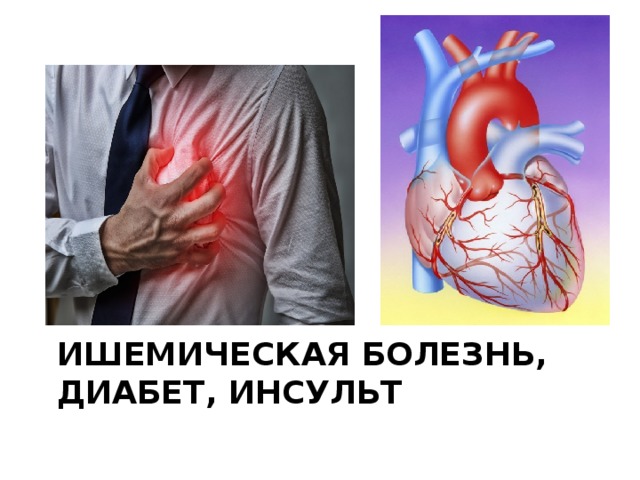ИШЕМИЧЕСКАЯ БОЛЕЗНЬ, ДИАБЕТ, ИНСУЛЬТ   
