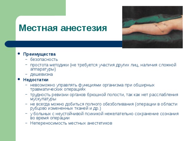 Местная анестезия Преимущества безопасность простота методики (не требуется участия других лиц, наличия сложной аппаратуры) дешевизна безопасность простота методики (не требуется участия других лиц, наличия сложной аппаратуры) дешевизна Недостатки невозможно управлять функциями организма при обширных травматических операциях трудность ревизии органов брюшной полости, так как нет расслабления мускулатуры не всегда можно добиться полного обезболивания (операции в области рубцово измененных тканей и др.) у больных с неустойчивой психикой нежелательно сохранение сознания во время операции Непереносимость местных анестетиков невозможно управлять функциями организма при обширных травматических операциях трудность ревизии органов брюшной полости, так как нет расслабления мускулатуры не всегда можно добиться полного обезболивания (операции в области рубцово измененных тканей и др.) у больных с неустойчивой психикой нежелательно сохранение сознания во время операции Непереносимость местных анестетиков 