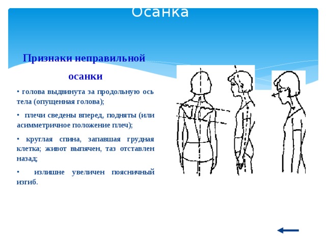 Осанка Признаки неправильной осанки • голова выдвинута за продольную ось тела (опущенная голова); • плечи сведены вперед, подняты (или асимметричное положение плеч); • круглая спина, запавшая грудная клетка; живот выпячен, таз отставлен назад; • излишне увеличен поясничный изгиб. 