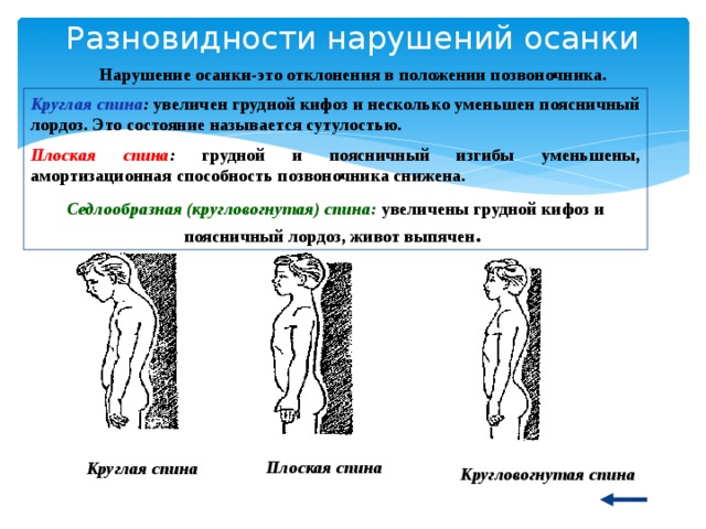 Разновидности нарушений осанки Нарушение осанки-это отклонения в положении позвоночника. Круглая спина : увеличен грудной кифоз и несколько уменьшен поясничный лордоз. Это состояние называется сутулостью. Плоская спина : грудной и поясничный изгибы уменьшены, амортизационная способность позвоночника снижена. Седлообразная (кругловогнутая) спина:  увеличены грудной кифоз и поясничный лордоз, живот выпячен . Плоская спина  Круглая спина  Кругловогнутая спина  