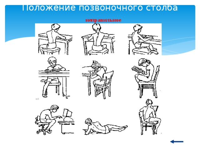 Положение позвоночного столба неправильное 