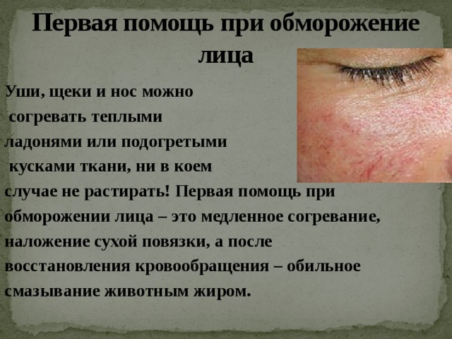 Первая помощь при обморожение  лица Уши, щеки и нос можно  согревать теплыми ладонями или подогретыми  кусками ткани, ни в коем случае не растирать! Первая помощь при обморожении лица – это медленное согревание, наложение сухой повязки, а после восстановления кровообращения – обильное смазывание животным жиром. 