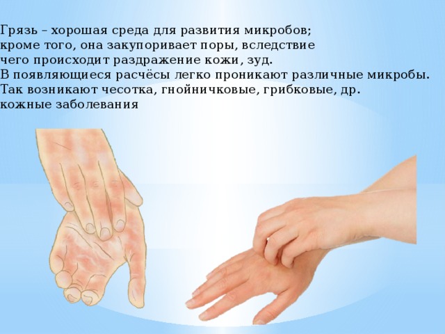 Грязь – хорошая среда для развития микробов; кроме того, она закупоривает поры, вследствие чего происходит раздражение кожи, зуд. В появляющиеся расчёсы легко проникают различные микробы. Так возникают чесотка, гнойничковые, грибковые, др. кожные заболевания 