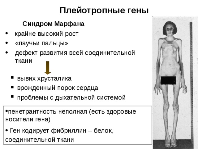  Плейотропные гены Синдром Марфана  крайне высокий рост «паучьи пальцы» дефект развития всей соединительной ткани  вывих хрусталика  врожденный порок сердца  проблемы с дыхательной системой  вывих хрусталика  врожденный порок сердца  проблемы с дыхательной системой пенетрантность неполная (есть здоровые носители гена)  Ген кодирует фибриллин – белок, соединительной ткани   