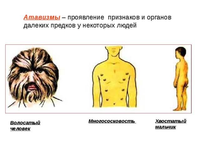 Атавизмы  – проявление признаков и органов далеких предков у некоторых людей Многососковость  Хвостатый мальчик Волосатый человек