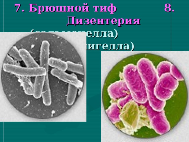 7. Брюшной тиф 8. Дизентерия  (сальмонелла) (шигелла) 